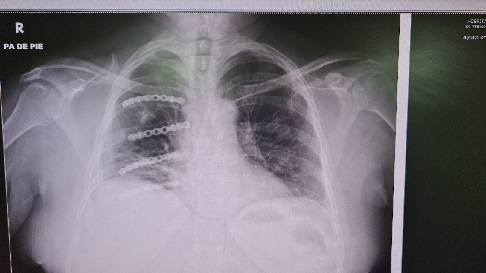 radiografia